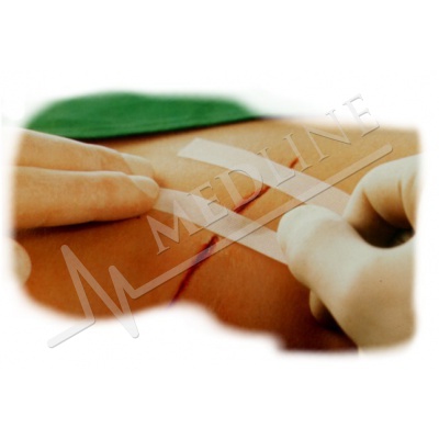 Medline | Elastic and adhesive sutures Leukostrip